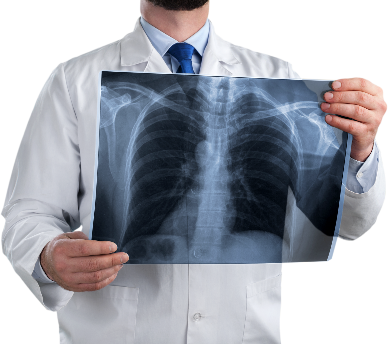 Doctor Examining X-Ray